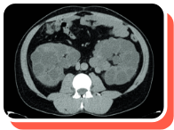 Kidney Volume Imaging, 2